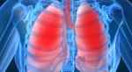 Phát hiện sớm bệnh phổi bẩm sinh
